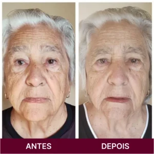 ANTES 2